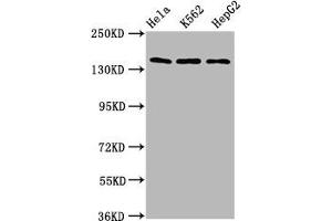 Western Blot Positive WB detected in: Hela whole cell lysate, K562 whole cell lysate, HepG2 whole cell lysate All lanes: SF3B1 antibody at 9. (SF3B1 Antikörper  (AA 186-378))