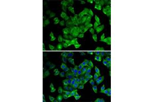Immunofluorescence analysis of MCF7 cells using PPL antibody (ABIN6128532, ABIN6146036, ABIN6146038 and ABIN6222699). (PPL Antikörper  (AA 1-130))