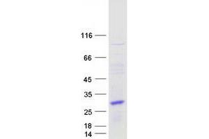 Validation with Western Blot