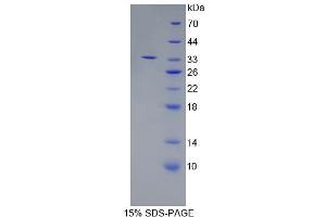Image no. 1 for Endoplasmic Reticulum Aminopeptidase 2 (ERAP2) (AA 41-271) protein (His tag) (ABIN4990553) (ERAP2 Protein (AA 41-271) (His tag))