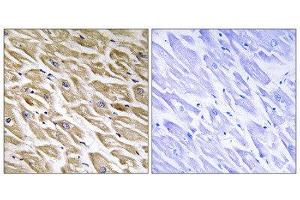 Immunohistochemistry (IHC) image for anti-Mitochondrial Ribosomal Protein L39 (MRPL39) (C-Term) antibody (ABIN1851576) (MRPL39 Antikörper  (C-Term))