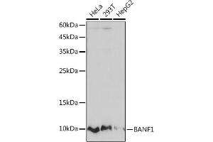 Western blot analysis of extracts of various cell lines, using B Rabbit mAb (ABIN7265826) at 1:1000 dilution. (BANF1 Antikörper)
