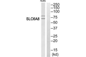 Western blot analysis of extracts from HuvEc cells, using SLC6A8 antibody. (SLC6A8 Antikörper  (C-Term))