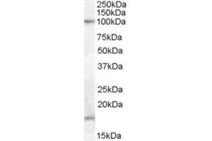 Western Blotting (WB) image for anti-Membrane-Associated Ring Finger (C3HC4) 6, E3 Ubiquitin Protein Ligase (MARCH6) (AA 701-712) antibody (ABIN303916) (MARCH6 Antikörper  (AA 701-712))