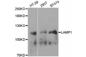 Western blot analysis of extracts of various cell lines, using LAMP1 antibody. (LAMP1 Antikörper  (AA 80-280))