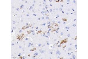 Immunohistochemistry (Paraffin-embedded Sections) (IHC (p)) image for anti-Cell Adhesion Molecule with Homology To L1CAM (Close Homolog of L1) (CHL1) antibody (ABIN7073418)