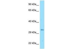 anti-DnaJ (Hsp40) Homolog, Subfamily C , Member 25 (DNAJC25) (AA 173-222) antibody