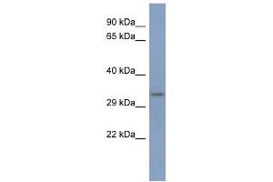 WB Suggested Anti-PCBP3 Antibody Titration:  0. (PCBP3 Antikörper  (Middle Region))
