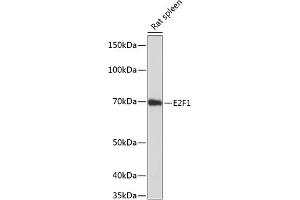Western blot analysis of extracts of rat spleen, using E2F1 antibody (ABIN7266873) at 1:1000 dilution. (E2F1 Antikörper)