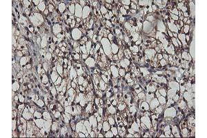 Image no. 2 for anti-V-Akt Murine Thymoma Viral Oncogene Homolog 1 (AKT1) antibody (ABIN1496554) (AKT1 Antikörper)