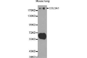 Western blot analysis of extracts of mouse lung, using COL5A1 antibody (ABIN5970709) at 1/500 dilution. (COL5A1 Antikörper)