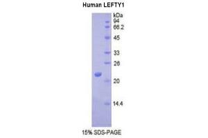 SDS-PAGE (SDS) image for Left-Right Determination Factor 1 (LEFTY1) (AA 167-332) protein (His tag) (ABIN2121539)