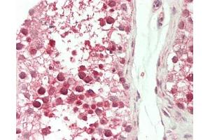 Human Testis: Formalin-Fixed, Paraffin-Embedded (FFPE). (Actin-Like 7A Antikörper  (FITC))