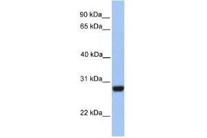 PAOX antibody used at 1 ug/ml to detect target protein. (PAOX Antikörper)