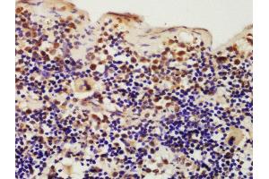 Formalin-fixed and paraffin embedded mouse spleen labeled with Rabbit Anti-IKIP Polyclonal Antibody, Unconjugated (ABIN872858) at 1:200 followed by conjugation to the secondary antibody and DAB staining (IKbIP Antikörper  (AA 250-350))