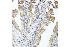 Immunohistochemistry of paraffin-embedded human prostate using STK3 antibody at dilution of 1:100 (x40 lens). (STK3 Antikörper)