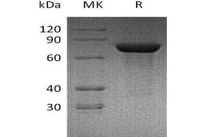 Western Blotting (WB) image for Transglutaminase 2 (C Polypeptide, Protein-Glutamine-gamma-Glutamyltransferase) (TGM2) protein (His tag) (ABIN7320672) (Transglutaminase 2 Protein (His tag))