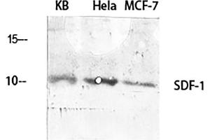 Western Blot analysis of KB (1), Hela (2), MCF-7 (3), diluted at 1:2000. (CXCL12 Antikörper  (C-Term))