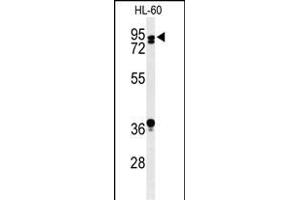 Western blot analysis of TL1 Antibody (C-term) (ABIN653753 and ABIN2843053) in HL-60 cell line lysates (35 μg/lane). (PATL1 Antikörper  (C-Term))