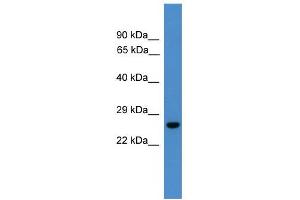 WB Suggested Anti-UCHL3 Antibody Titration: 0. (UCHL3 Antikörper  (C-Term))