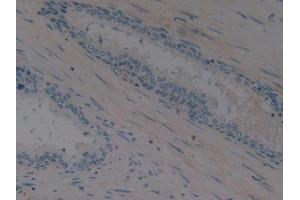 Detection of EPO in Human Prostate Tissue using Polyclonal Antibody to Erythropoietin (EPO)