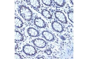 Immunohistochemistry of paraffin-embedded human colon using CDC40 Rabbit mAb (ABIN7266255) at dilution of 1:100 (40x lens). (CDC40 Antikörper)