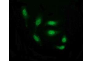 Image no. 6 for anti-THUMP Domain Containing 1 (THUMPD1) antibody (ABIN1501384) (THUMPD1 Antikörper)