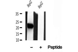 Western blot analysis of extracts of HepG2 cells, using Tim23 antibody. (TIMM23 Antikörper  (N-Term))
