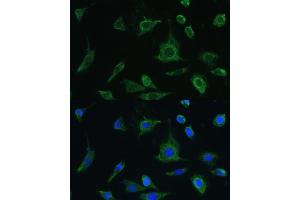Immunofluorescence analysis of L-929 cells using Oncostatin M antibody (ABIN6128404, ABIN6145072, ABIN6145073 and ABIN6221768) at dilution of 1:100. (Oncostatin M Antikörper  (AA 26-252))