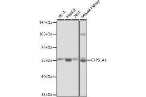 Western blot analysis of extracts of various cell lines, using CYP51 antibody (3485) at 1:1000 dilution.