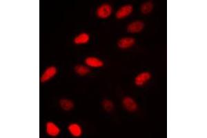 Immunofluorescent analysis of NCOR1 staining in HeLa cells. (NCOR1 Antikörper  (N-Term))