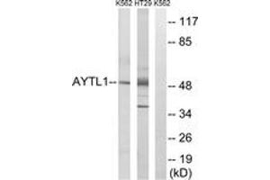 Western Blotting (WB) image for anti-Lysophosphatidylcholine Acyltransferase 2 (LPCAT2) (AA 321-370) antibody (ABIN2890096) (LPCAT2 Antikörper  (AA 321-370))
