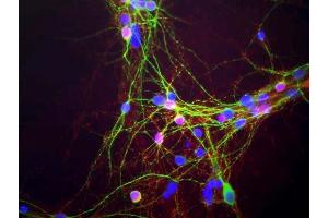 Mixed neuron-glial cultures stained with ABIN1580411, our monoclonal antibody to α-synuclein (red) and chicken polyclonal antibody to MAP2 CPCA-MAP2 (green). (SNCA Antikörper)