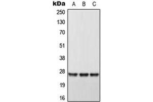 Western blot analysis of DHRS2 expression in HeLa (A), Raw264. (DHRS2 Antikörper  (Center))