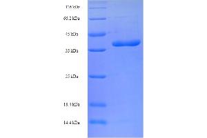 SDS-PAGE (SDS) image for BCL2-Like 11 (Apoptosis Facilitator) (BCL2L11) (AA 1-198), (full length) protein (His-SUMO Tag) (ABIN5709129)