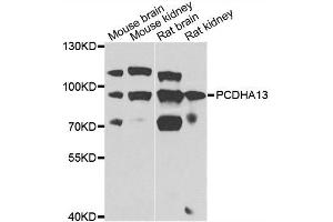 Western blot analysis of extracts of various cell lines, using PCDHA13 antibody. (PCDHa13 Antikörper)