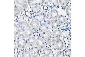 Immunohistochemistry of paraffin-embedded mouse kidney using SSN Rabbit pAb (3377) at dilution of 1:100 (40x lens). (SSNA1 Antikörper  (AA 1-119))