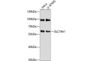Western blot analysis of extracts of various cell lines, using SLC19 antibody (2819) at 1:3000 dilution. (SLC19A1 Antikörper  (AA 452-591))