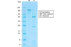SDS-PAGE Analysis of Purified CD1a-Monospecific RecombinantRabbit Monoclonal Antibody (C1A/1506R). (Rekombinanter CD1a Antikörper)