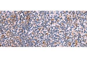 Immunohistochemistry of paraffin-embedded Human tonsil tissue using ITGA11 Polyclonal Antibody at dilution of 1:75(x200) (ITGA11 Antikörper)