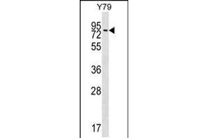 Western blot analysis in Y79 cell line lysates (35ug/lane). (MAK Antikörper  (C-Term))