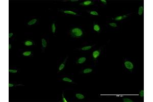 Immunofluorescence of purified MaxPab antibody to ZFP42 on HeLa cell.