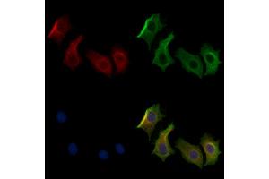ABIN7094296 and ABIN7098343 staining HepG2 cells by IF/ICC.