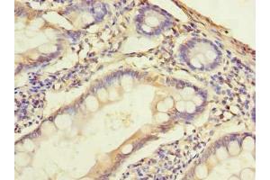 Immunohistochemistry of paraffin-embedded human small intestine tissue using ABIN7169964 at dilution of 1:100 (SLC38A2 Antikörper  (AA 1-76))