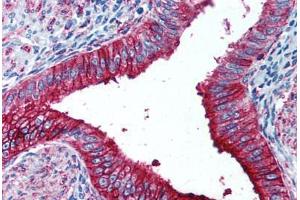 Human Uterus (formalin-fixed, paraffin-embedded) stained with FUT4 antibody ABIN297072 at 1:50 followed by biotinylated anti-mouse IgG secondary antibody ABIN481714, alkaline phosphatase-streptavidin and chromogen. (CD15 Antikörper)