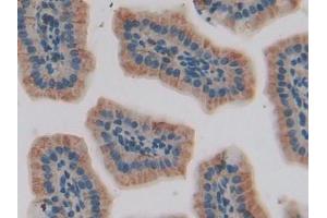 DAB staining on IHC-P; Samples: Mouse Small intestine Tissue (IGFBP5 Antikörper  (AA 25-271))
