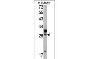 Western blot analysis of HOXA5 antibody (C-term ) (ABIN390648 and ABIN2840947) in mouse kidney tissue lysates (35 μg/lane). (HOXA5 Antikörper  (C-Term))