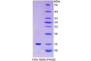 SDS-PAGE analysis of Human AGGF1 Protein. (AGGF1 Protein)