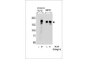 Western blot analysis of extracts from A431 cells,untreated or treated with EGF,100 ng/mL,using phospho HER2- (left) or HER2 Antibody (right) (ErbB2/Her2 Antikörper  (pTyr1112))