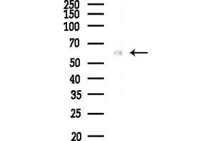 Western blot analysis of lysates from Rat liver, using Gliomedin Antibody at 1/1000 dilution.